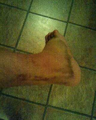 foot3.JPG