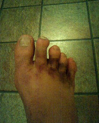 foot4.JPG