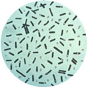 apis-uk0805_botulism_spores.jpg