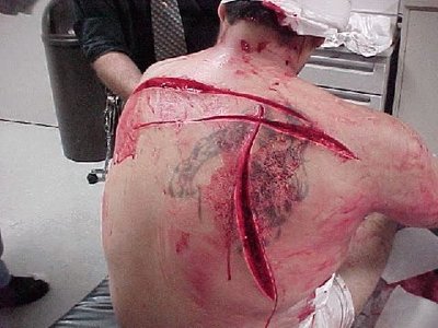 knife wounds.jpg